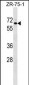 SRPR Antibody (C-term)